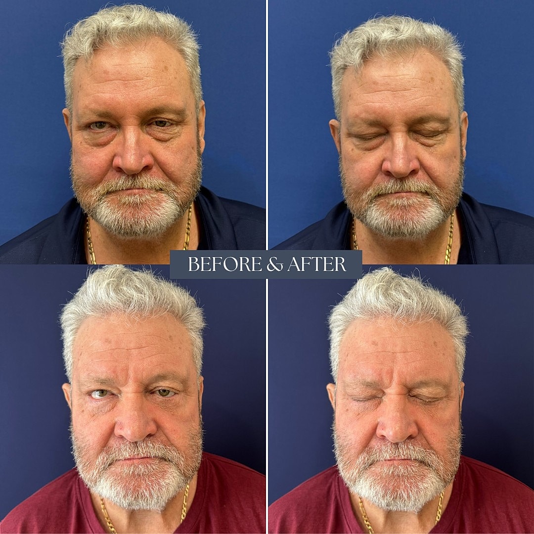 Before and after facial transformation comparison.