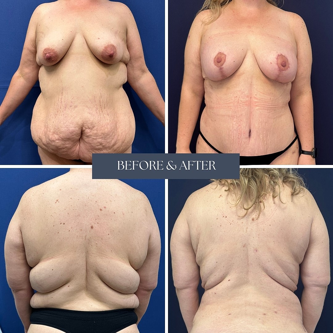 Body transformation before and after images.