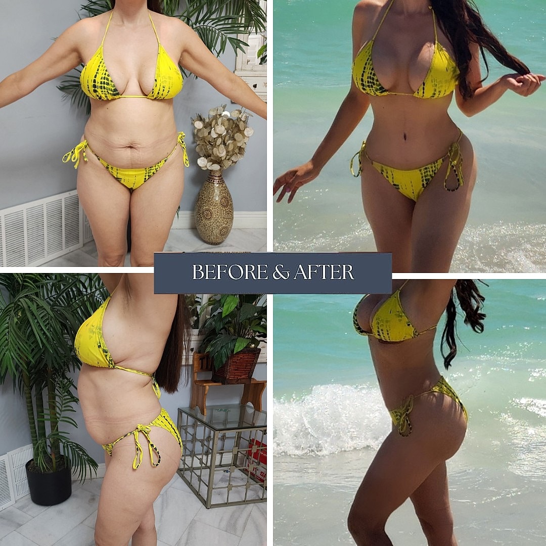 Before and after bikini transformation comparison.