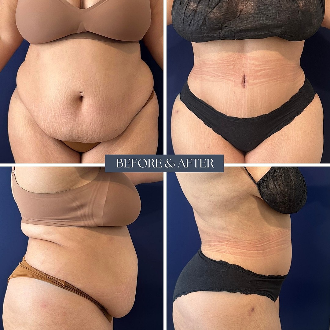 Before and after body transformation photos.