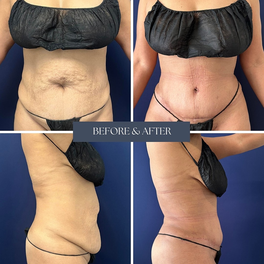 Body transformation before and after images.