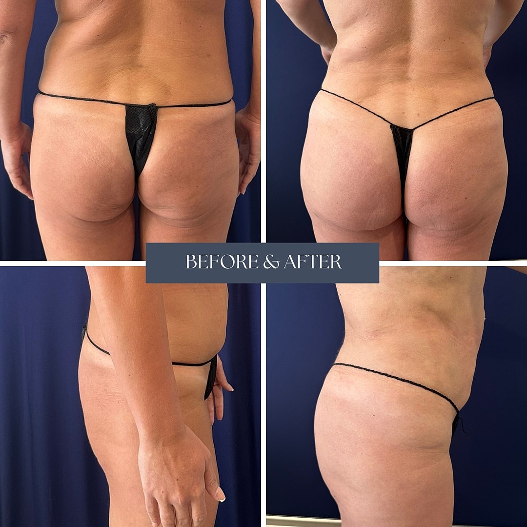 Body transformation before and after images