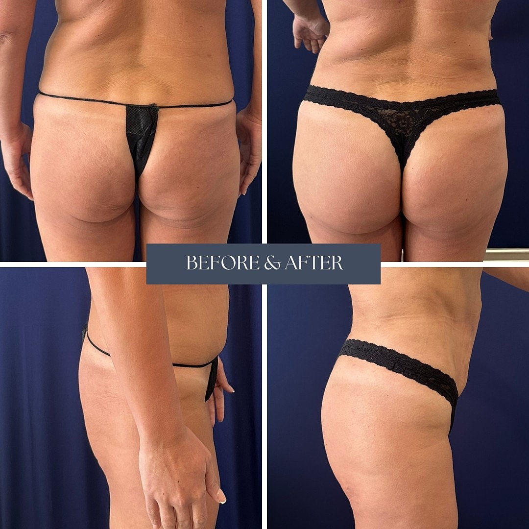 Body transformation before and after images